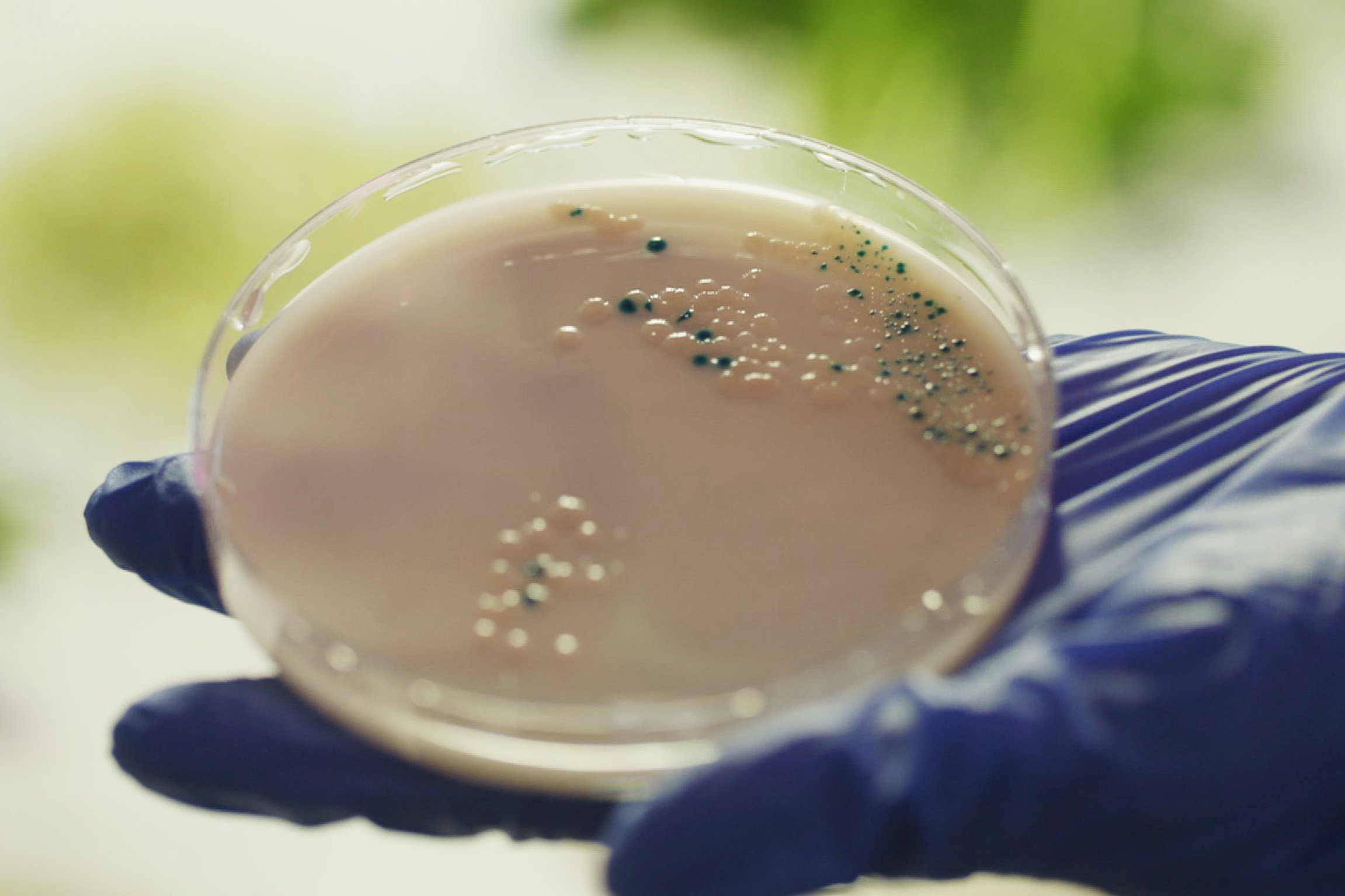Einstein Sieg der Keime - Vom Ende der Antibiotika